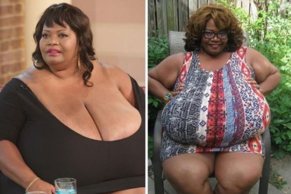 Женщина разбогатела благодаря своей 60-кг груди